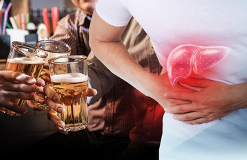 Giải pháp chuyên biệt chăm sóc lá gan trước tác hại của bia rượu