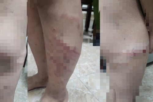 Giám đốc Công an Phú Thọ chỉ đạo điều tra vụ bé 11 tuổi bị mẹ và người tình đánh