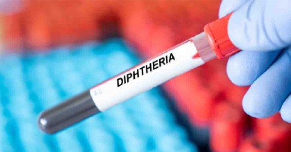 Cách ly 15 F1 liên quan đến ca bệnh bạch hầu ở Bắc Giang