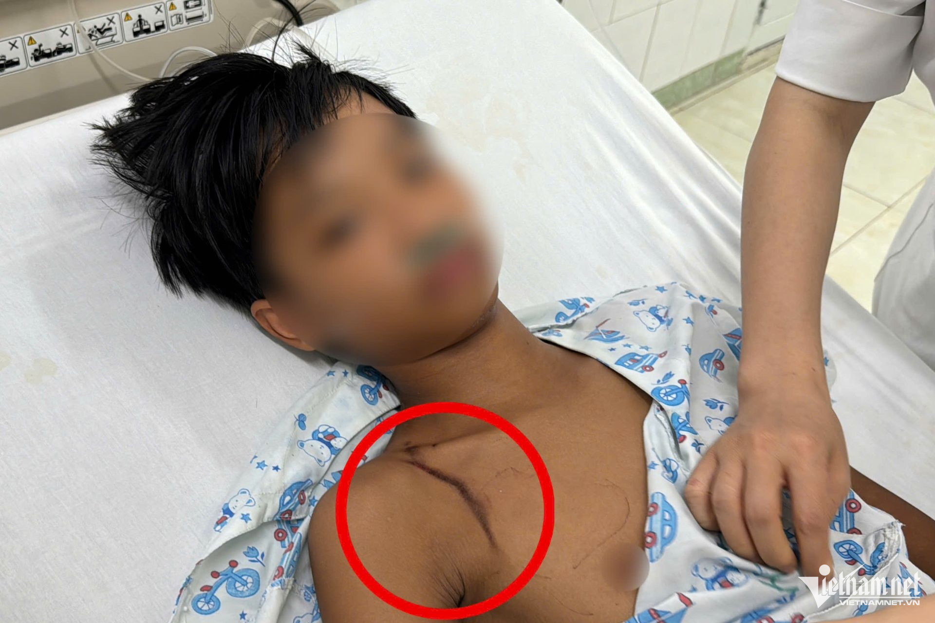 W-set danh dong nai.jpg