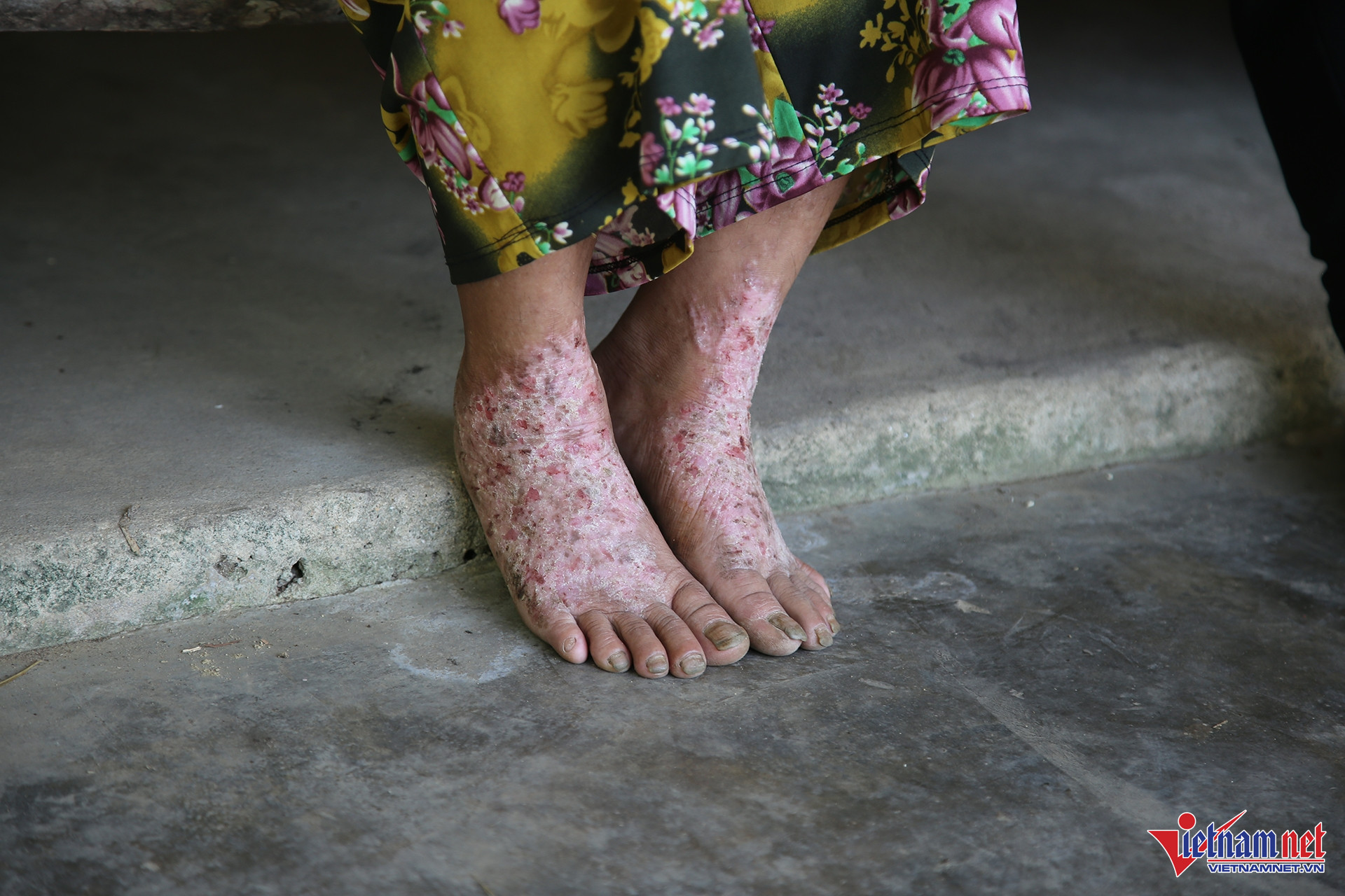 W-tâm thần3.JPG.jpg