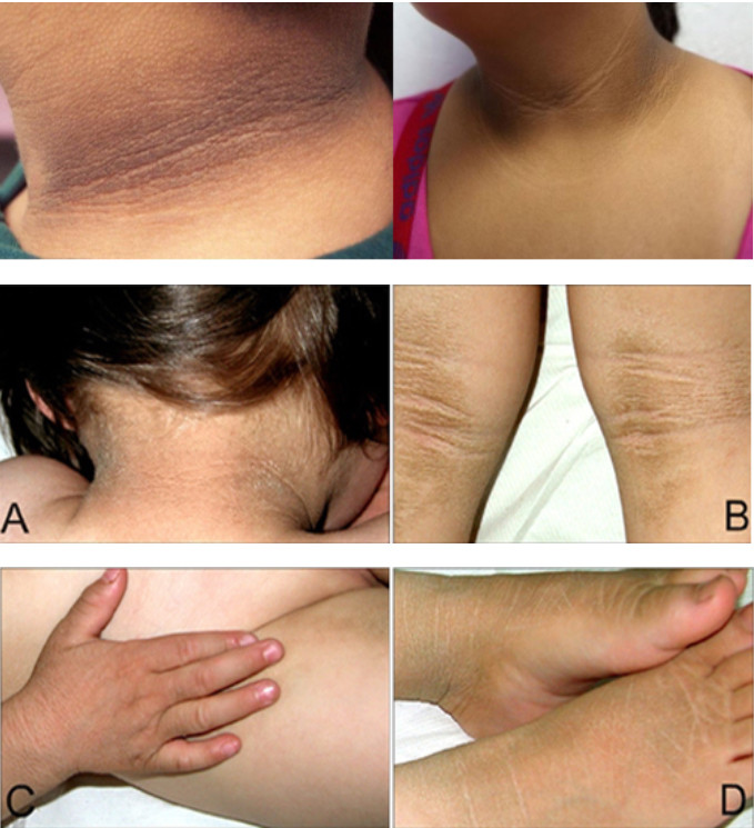 6 đen cảnh báo bệnh tiểu đường tieu duong 1a.jpg