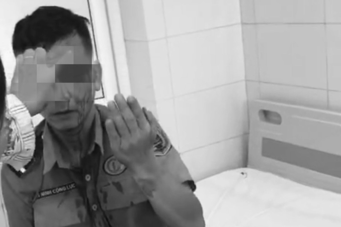 Bảo vệ Bệnh viện K bị 'cò nhà trọ' hành hung