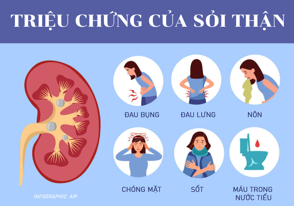 10. Những Lưu Ý Quan Trọng Khi Điều Trị Sỏi Thận