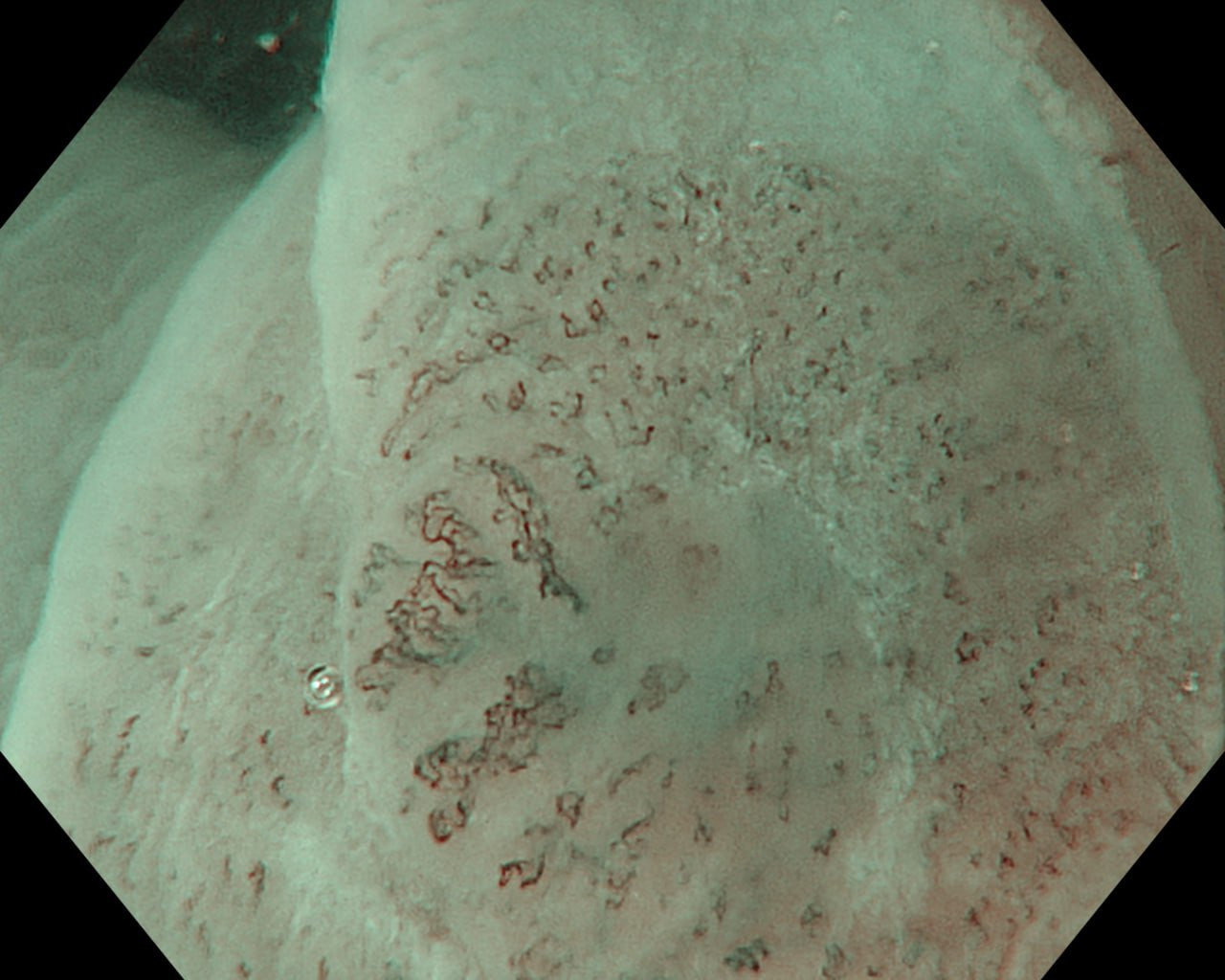 1 ton thuong thuc quan.jpg