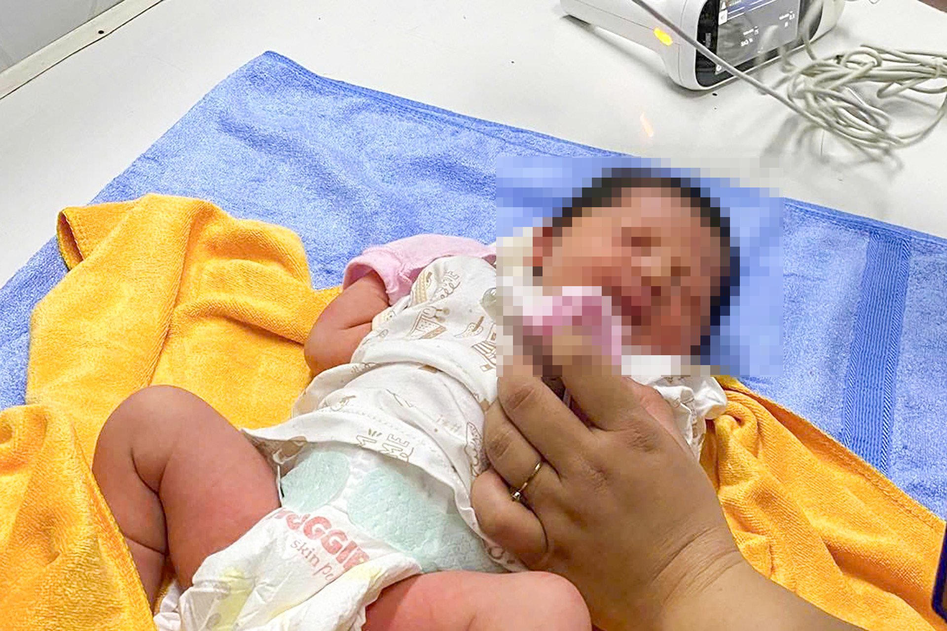 Be so sinh bi bo roi.jpg