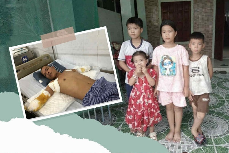 Xót xa người đàn ông lợp mái nhà giúp dân sau bão bị điện phóng cụt 2 tay