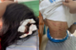 a aa Bạo hành.webp