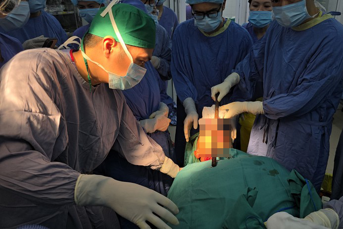 Cap Cuu Thanh Cong Nam Sinh Bi Thanh Sat 3 Met Xuyen Tu Mat Qua Gay 1874