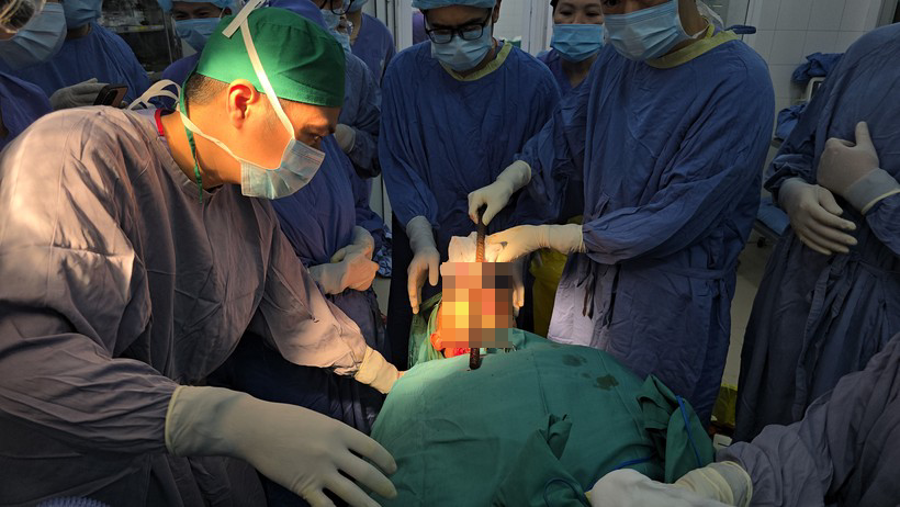 mo cap cuu cho nam sinh.png