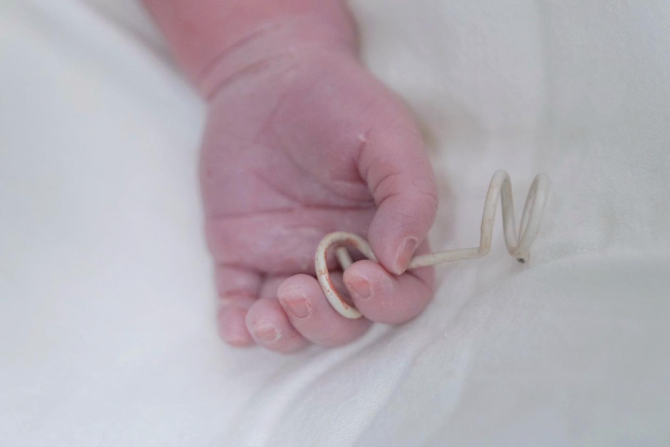 Chiếc ống nhỏ cứu em bé từ trong bụng mẹ