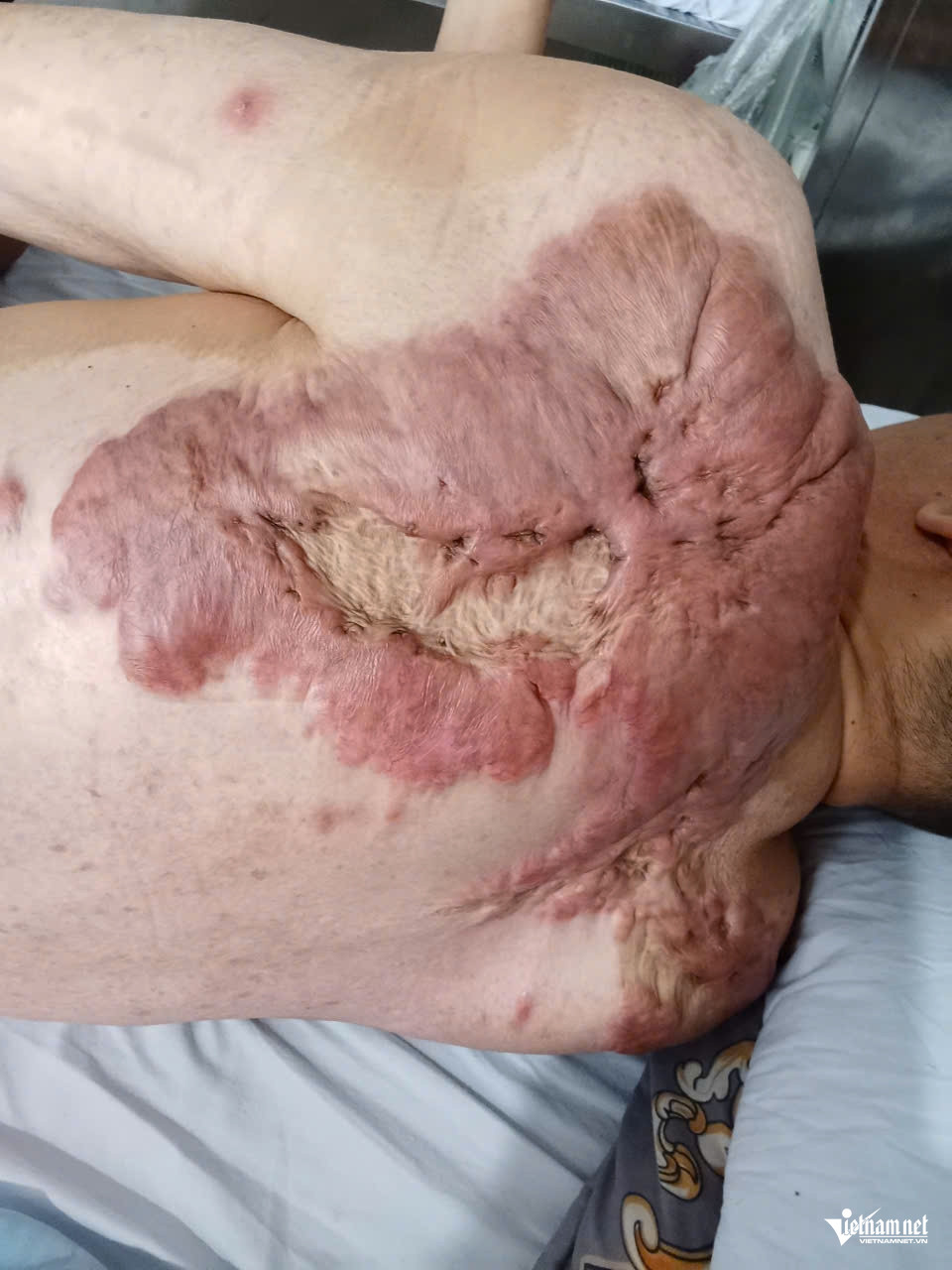 W-a con a Thịnh2.jpg