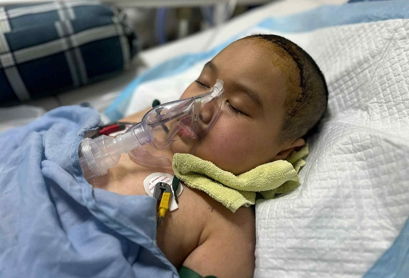 Bé gái mắc u não nguy hiểm, gia đình nghèo cầu cứu cộng đồng giúp đỡ