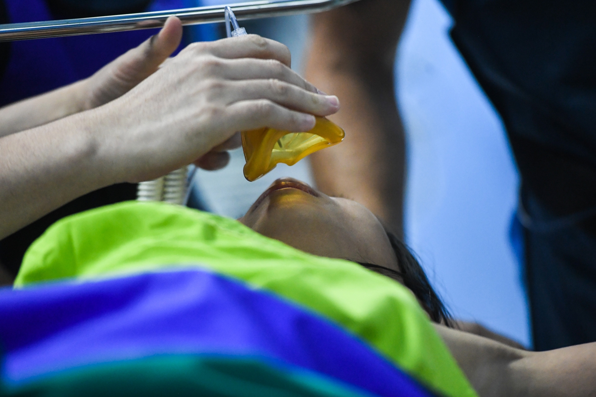 Người phụ nữ tử vong do bị bác sĩ bỏ quên băng gạc trong cơ thể