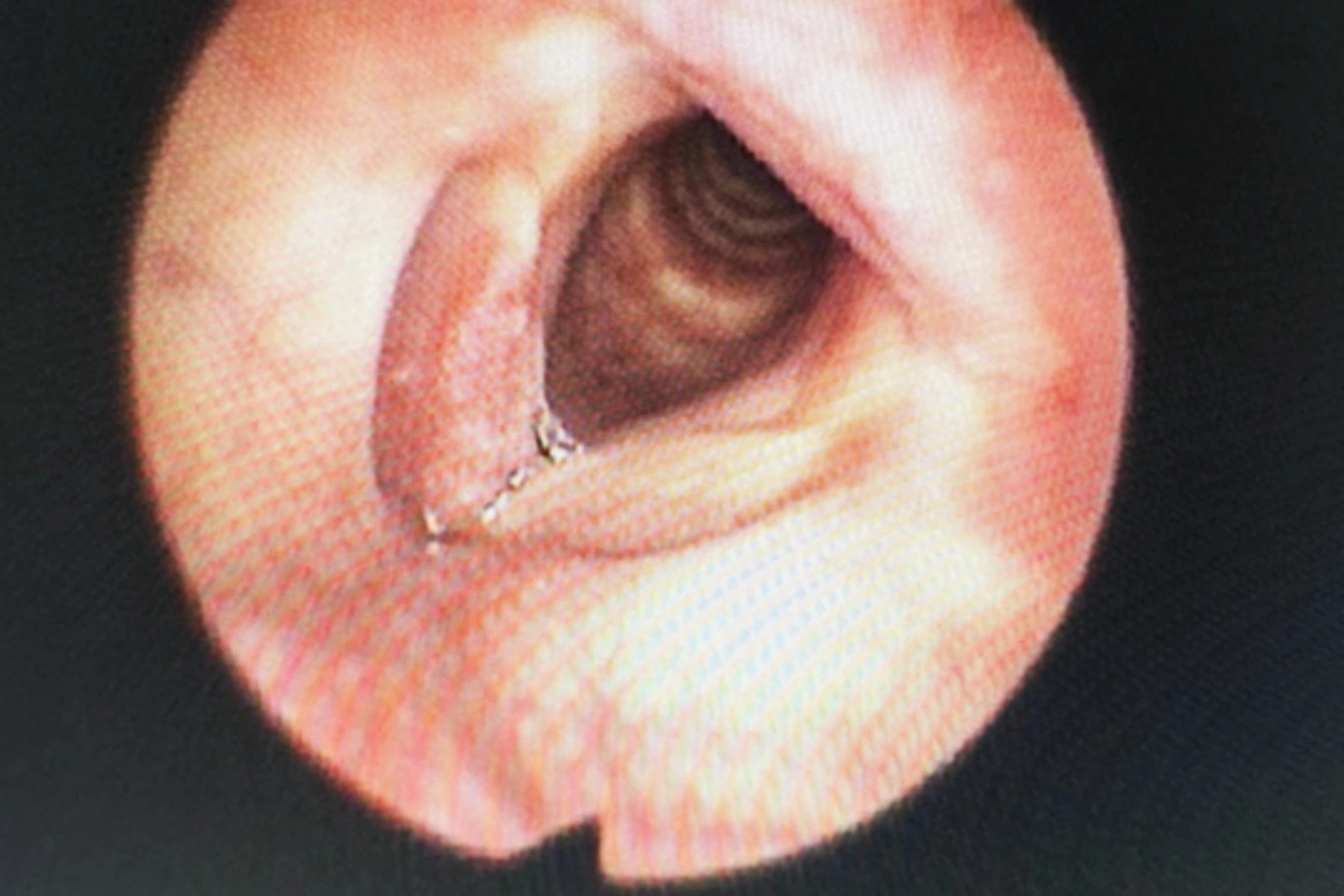 BV Tai mũi họng TPHCM 001