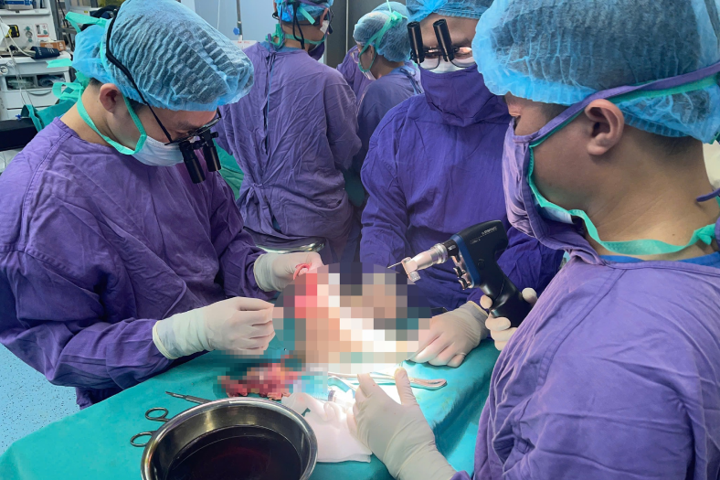 Nối chân bị đứt lìa cho cho cô gái va chạm với mô tô phân khối lớn