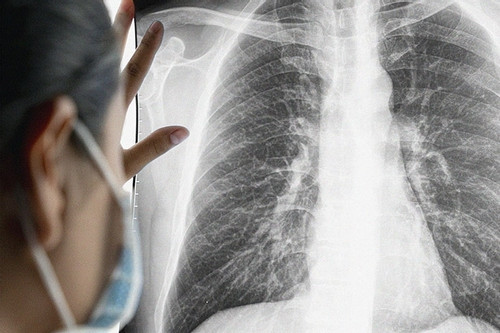 Người phụ nữ ung thư giai đoạn cuối, bật khóc khi biết thủ phạm từ chồng con