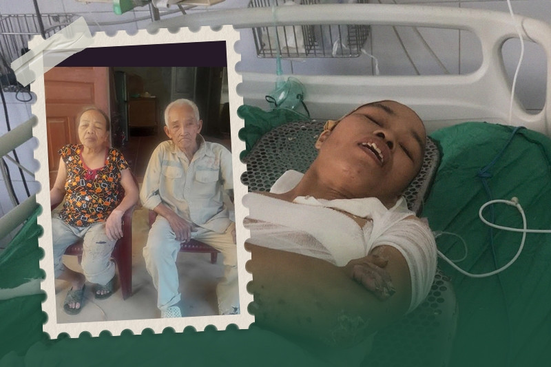 Con gái ngã vào đống lửa bỏng nặng, cha mẹ nghèo bán sạch thóc không đủ tiền cứu