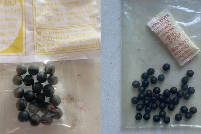 Khớp gối biến dạng, tuyến thượng thận bị suy do uống thảo dược mua từ nước ngoài