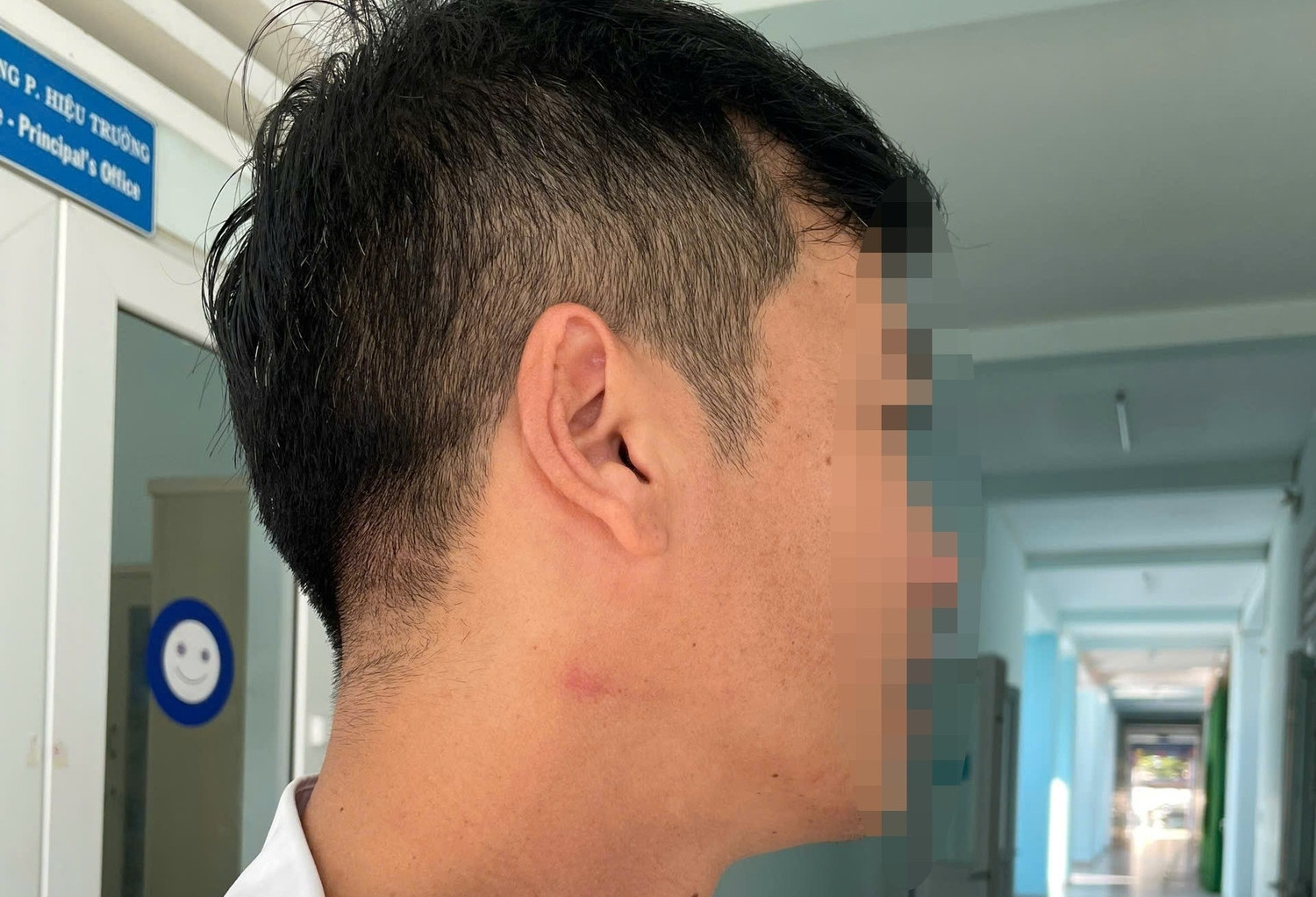 Thầy giáo bị đồng nghiệp bóp cổ giữa sân trường vì nhắc đỗ xe sai quy định