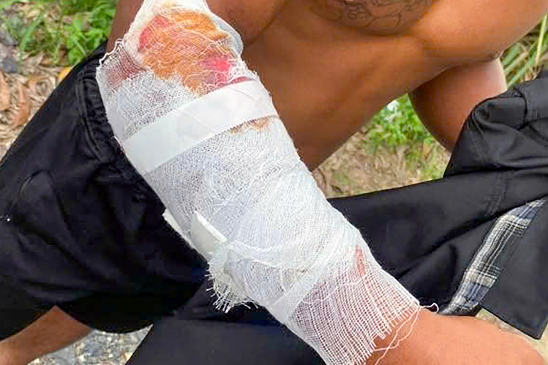 Cá sấu sổng khỏi khu du lịch, tấn công người dân