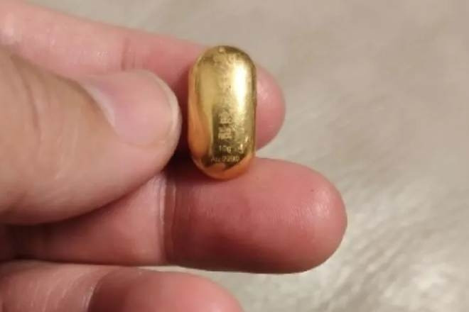 Con trai 11 tuổi nuốt hạt đậu vàng 10g, mẹ 'khóc dở mếu dở' suốt 5 ngày