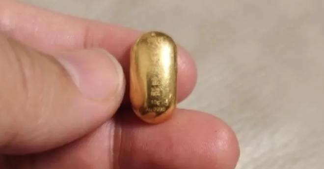 Con trai 11 tuổi nuốt hạt đậu vàng 10g, mẹ &amp;apos;khóc dở mếu dở&amp;apos; suốt 5 ngày