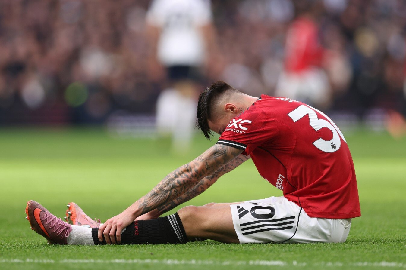 MU tá hỏa vì Sesko dính chấn thương nặng