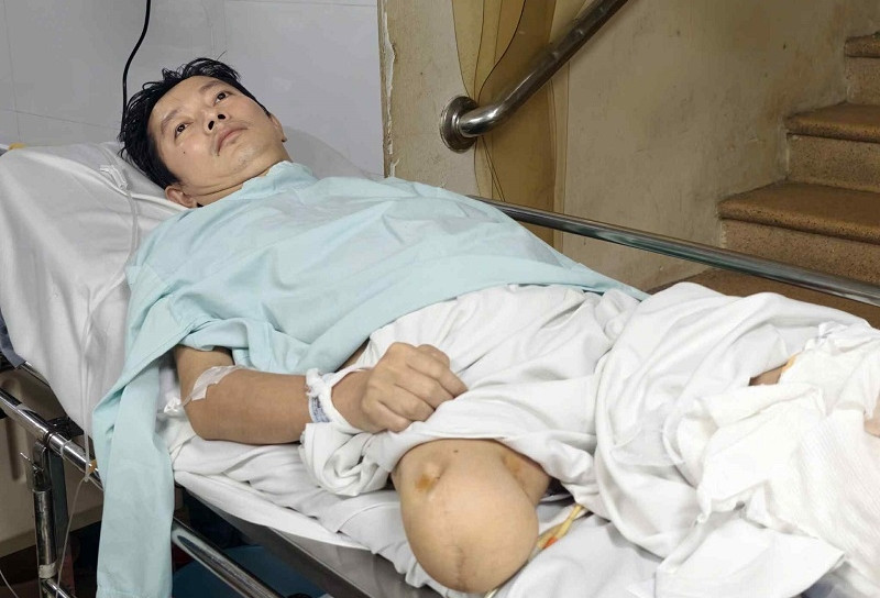 Người đàn ông có nguy cơ mất nốt chân còn lại sau tai nạn mong được giúp đỡ
