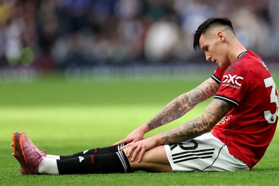 Cập nhật mới nhất về chấn thương Sesko, MU thở phào