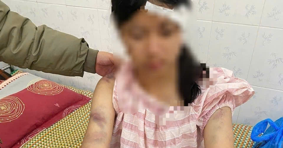 Bản tin trưa 20/11: Sức khỏe bé gái bị bà nội và 2 người đàn ông bạo hành