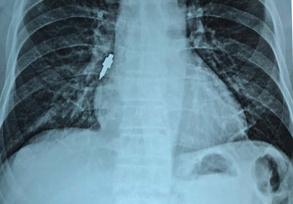 di_vat_2_fzvy (1).png