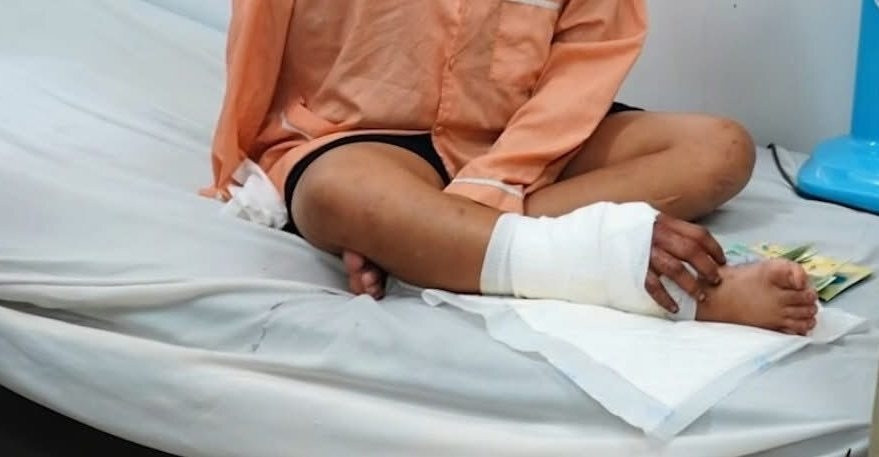 5140_ban tay cay ghep vao chan.jpg