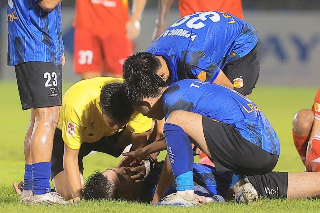 Trọng tài kịp thời ngăn cầu thủ HAGL cắn lưỡi