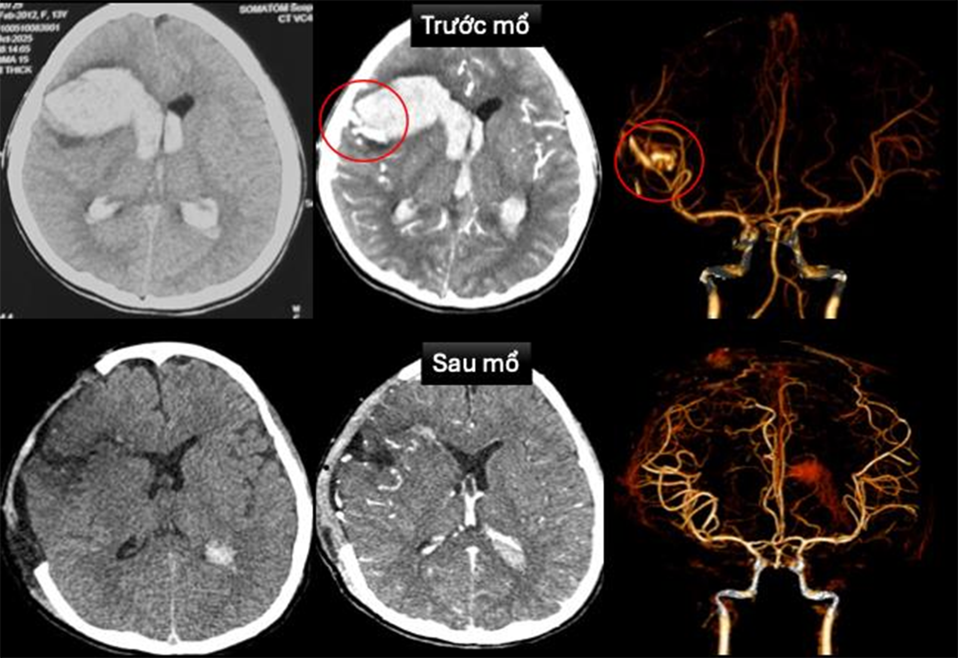 BV Nhi dong 1 001.png