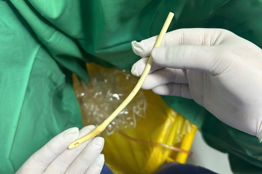 Con hốt hoảng khi cụ ông cắt phăng thiết bị y tế vì 'loằng ngoằng'