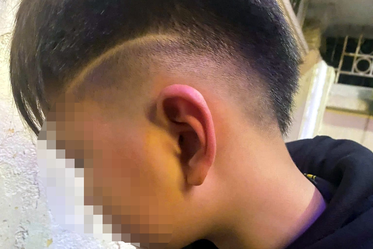 Công an vào cuộc vụ bé trai 12 tuổi ở Hà Nội nghi bị bố bạn học hành hung
