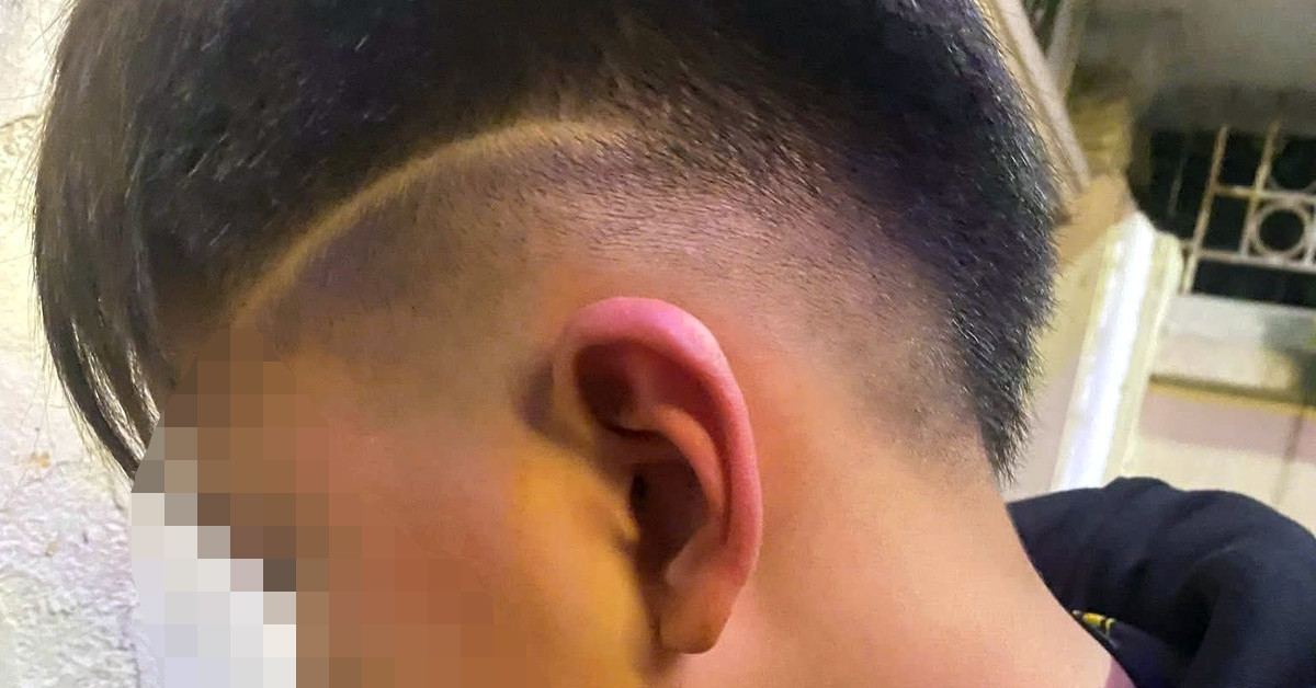 Công an vào cuộc vụ bé trai 12 tuổi ở Hà Nội nghi bị bố bạn học hành hung