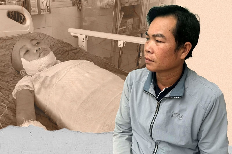 Cha nghèo ăn mì tôm cầm hơi, bất lực nhìn con bỏng nặng chờ ghép da