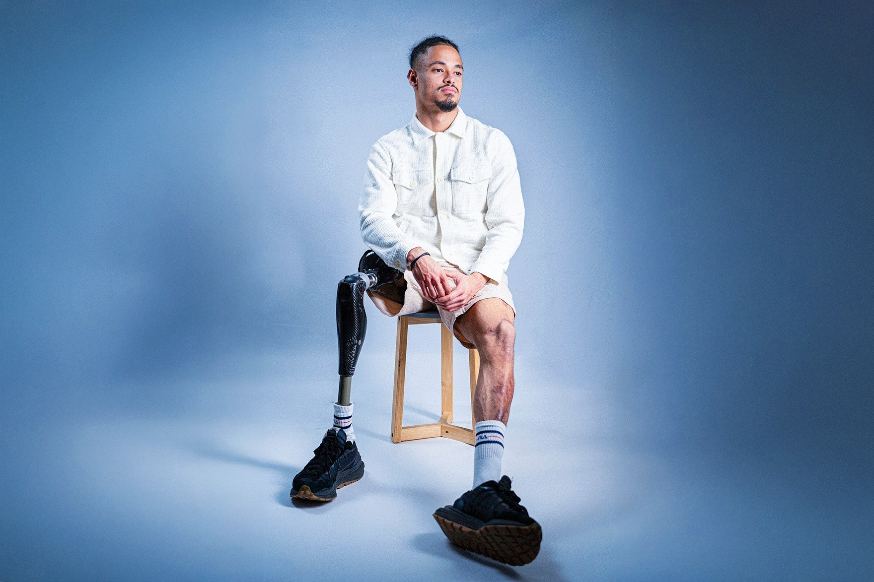 Cầu thủ Pháp phải cắt một chân sau biến chứng nguy hiểm do não mô cầu