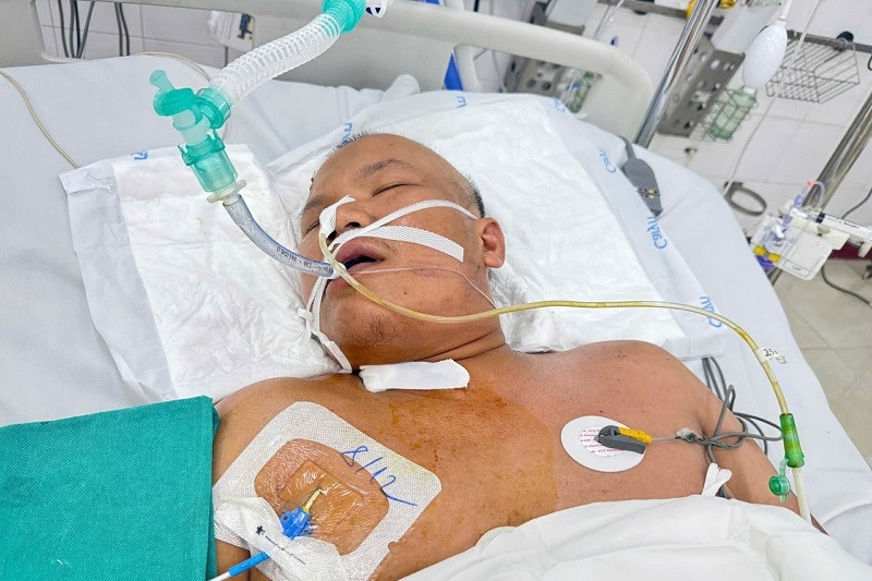  Hơn 300 triệu đồng viện phí đè nặng gia đình người đàn ông đang hôn mê sâu 