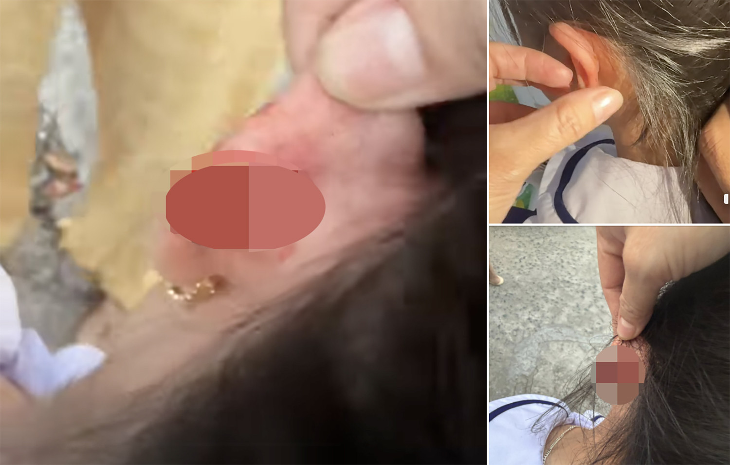 PH tố giáo viên véo tai.jpg