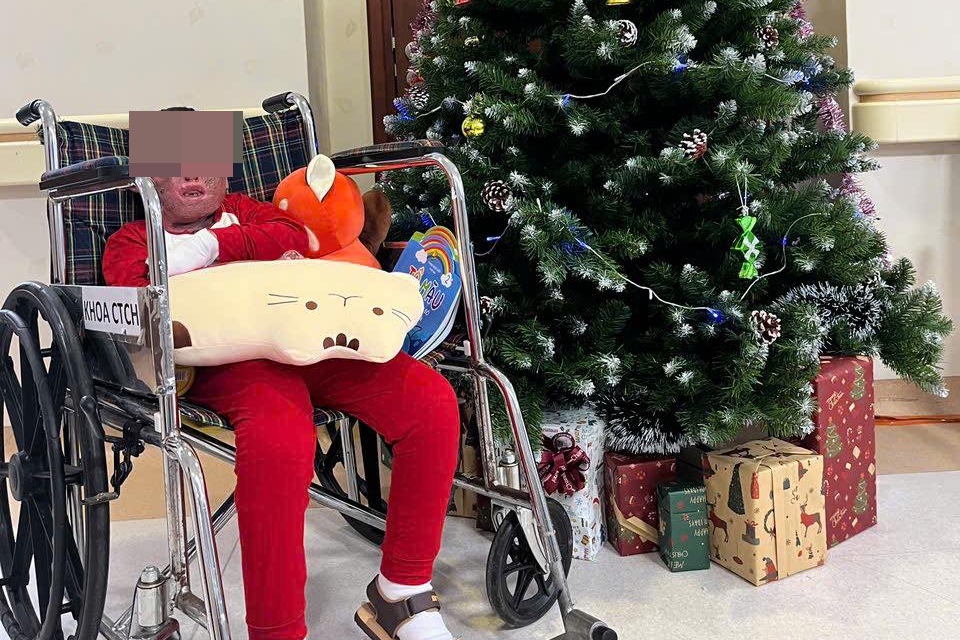 96 ngày vượt qua cửa tử của cậu bé bị cha tưới xăng đốt phòng trọ