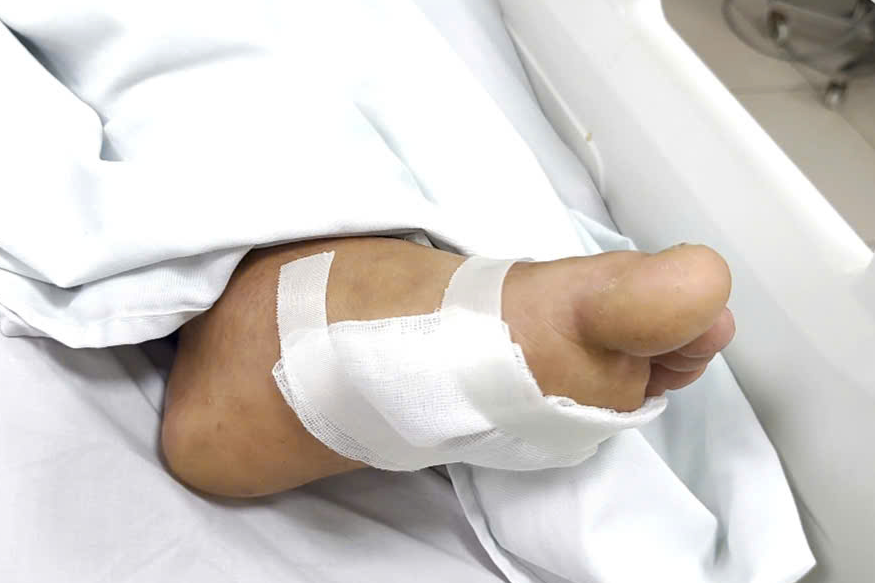 Liên tiếp nhiều người cấp cứu vì vết xước nhỏ xíu