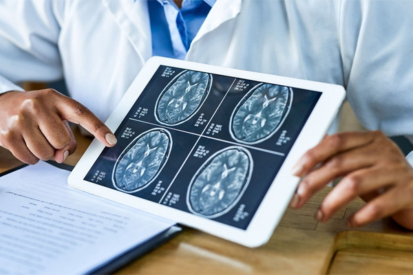 Cô gái nhập viện vì áp xe nặng sau tiêm filler nâng vòng một Sau cú ngã trong nhà, người đàn ông vỡ xương sọ, rơi vào hôn mê