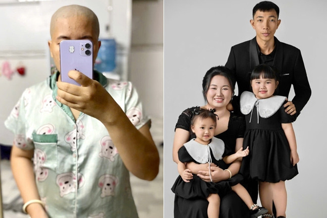 Vợ cạo trọc đầu vì trầm cảm, chồng làm điều xúc động, dìu qua biến cố