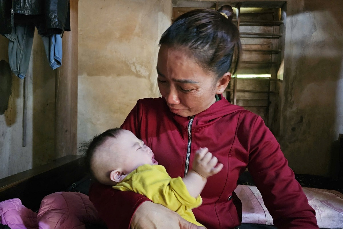 Bé 8 tháng tuổi mắc 3 bệnh bẩm sinh, cha mẹ cùng đường không có tiền cứu