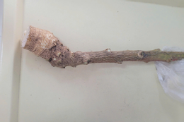 15 phút quyết định mở hộp sọ cứu bệnh nhân bị tai nạn nghiêm trọng Cấp cứu 2 người sốc phản vệ nghiêm trọng do ăn thảo dược truyền miệng