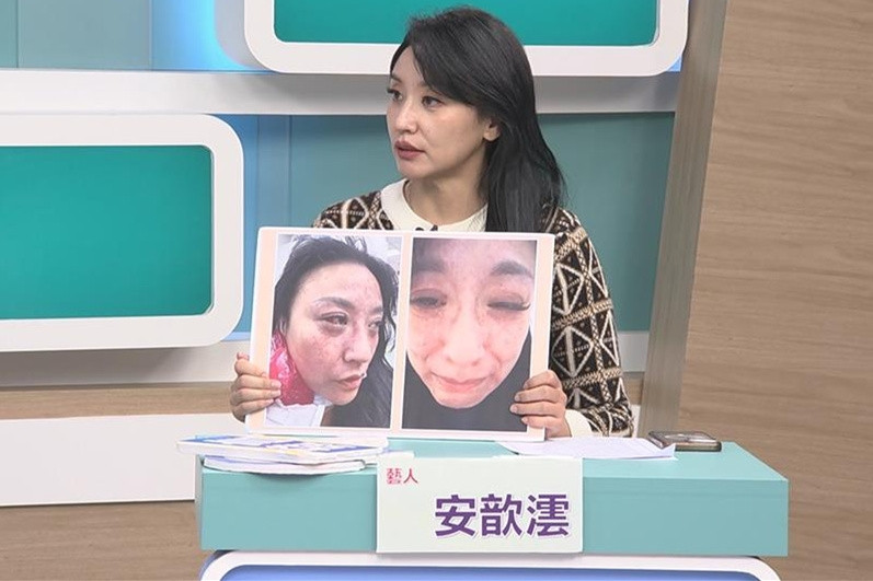 Ca sĩ Tâm Vân bị chồng kém 16 tuổi đánh đến ngất xỉu, dọa giết