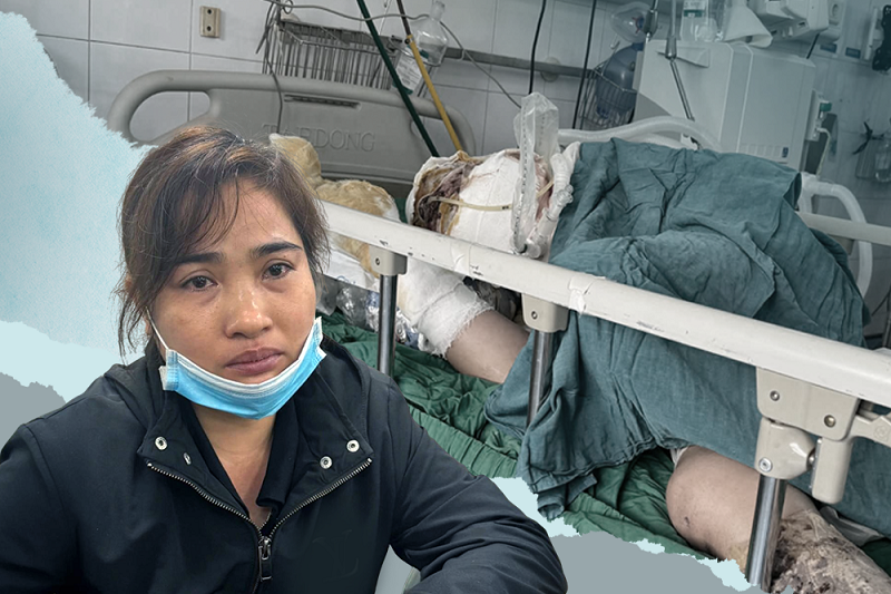 Chồng nguy kịch vì bỏng, con mắc bệnh di truyền: Vợ nghèo kiệt quệ cầu cứu